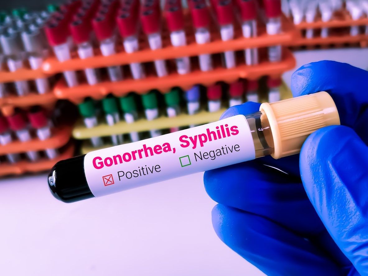 Gonorrhoea, syphilis on rise in England: Health agency - EasternEye