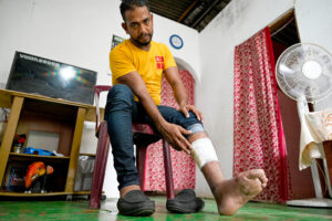 INSET 1 Anil Madusanka a hotel driver who had joined Russian forces shows his wound during an interview with AFP at his residence in Colombo.